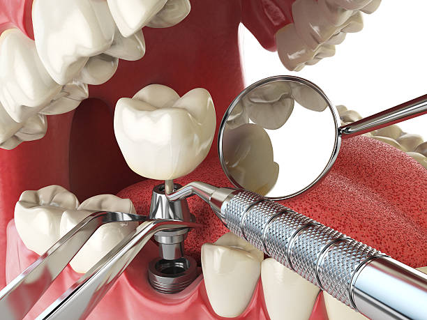 Best Emergency Denture Repair in New Freedom, PA