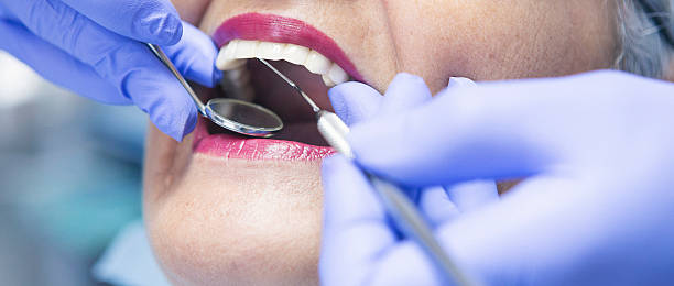 Best Knocked-Out Tooth (Avulsed Tooth) Treatment in New Freedom, PA